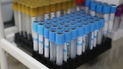  Проверяться на гепатит C нужно ежегодно — минздрав Ставрополья   
